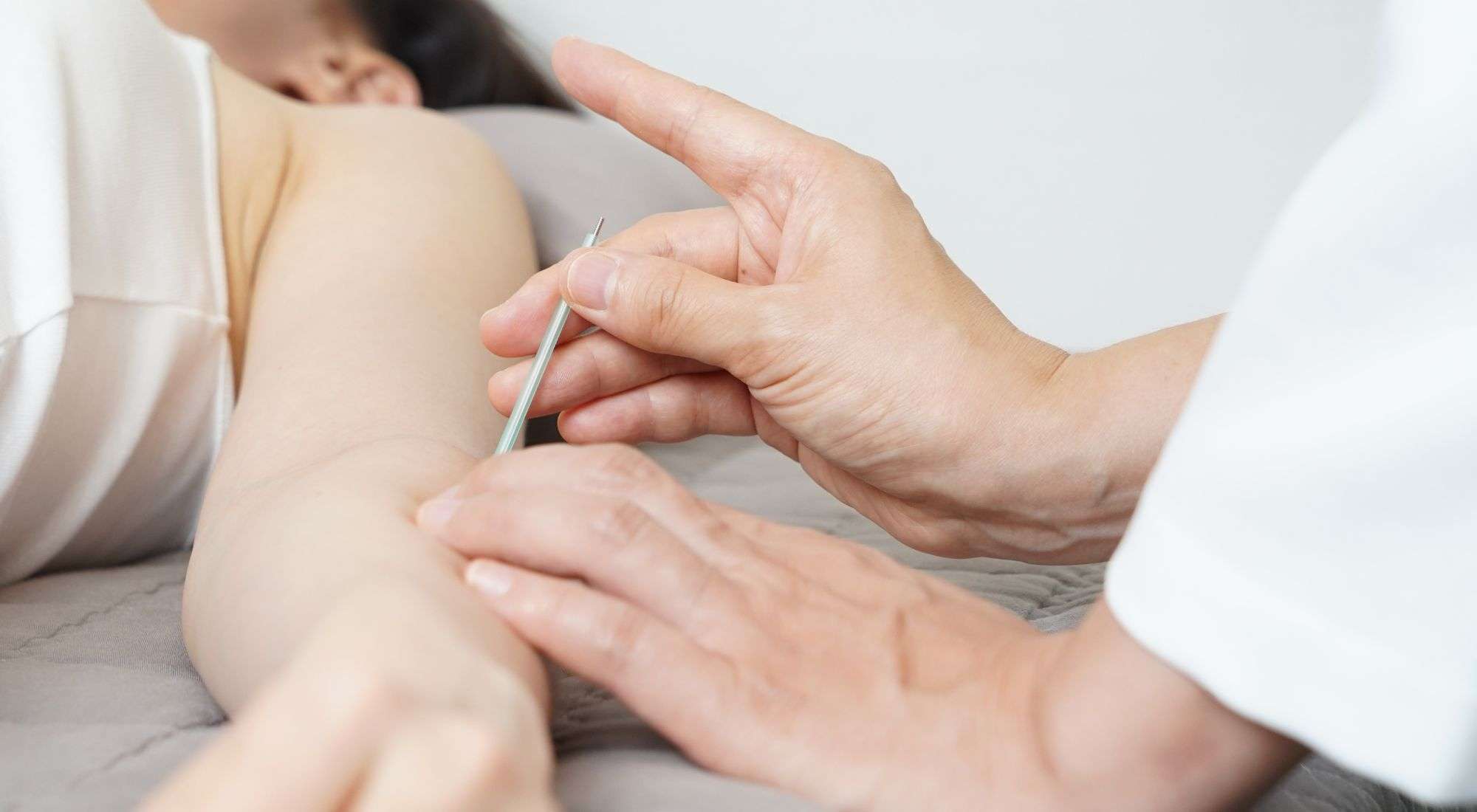Acupuncture